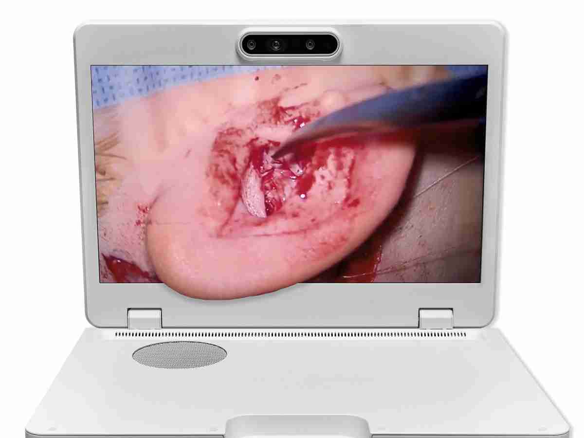 达擎之＂Heads-up 3D显微手术显示系统＂，，，整合4K裸眼3D显示及眼球追踪系统，，，具备快速追踪人眼移动位置功能，，，，减轻医师长时间维持固定姿势的负担，，，，让医师能有更宽广清晰的3D立体视野及更舒适的姿势来执行手术。。。。